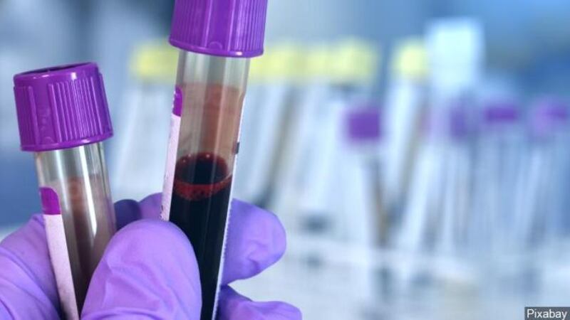 "If you are type A, there is no need to panic. It does not mean you will be infected 100...